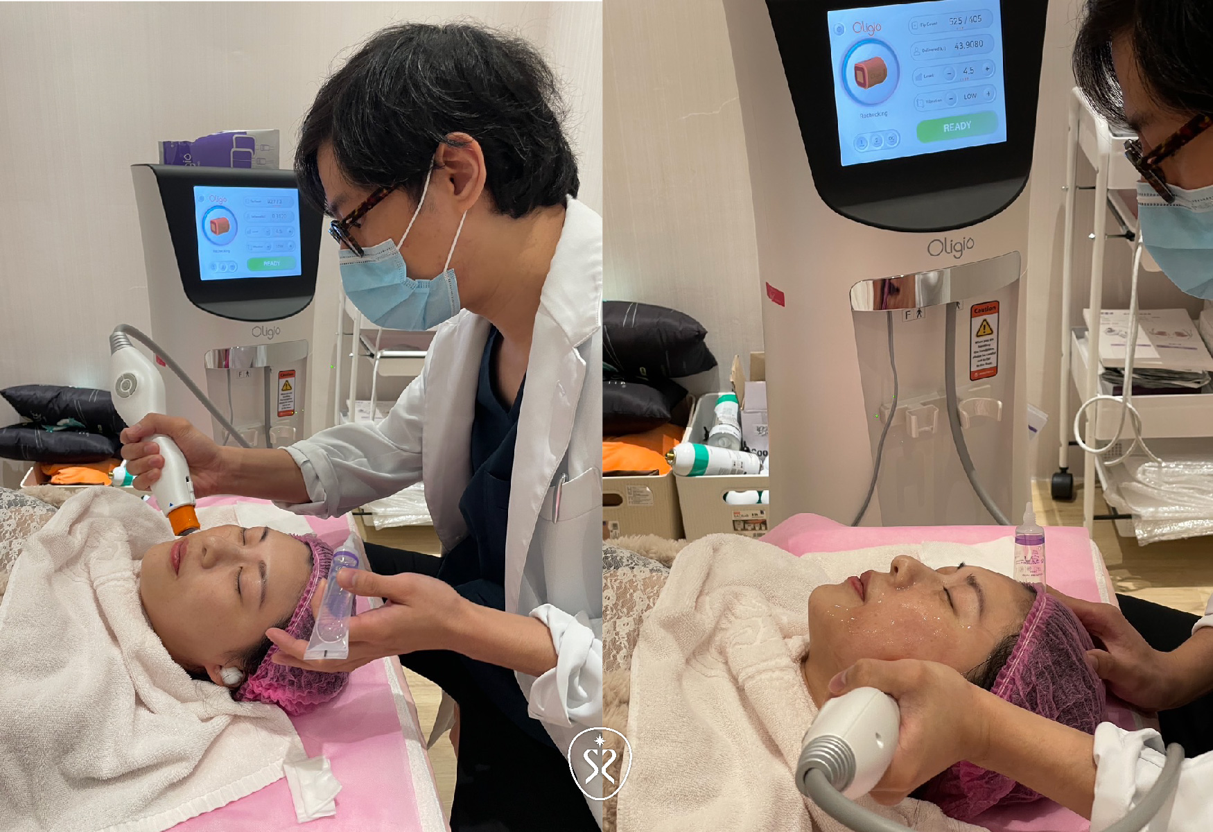 玩美電波有全方位治療探頭及眼周治療探頭兩種，都可以透過醫師諮詢安排適合的療程